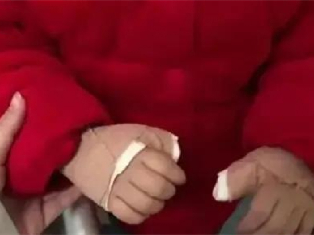 家长们，别再把手机当“哄娃利器”，3岁娃因此手指僵硬伸不直